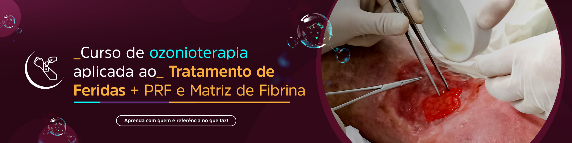 BANNER_Curso_Feridas